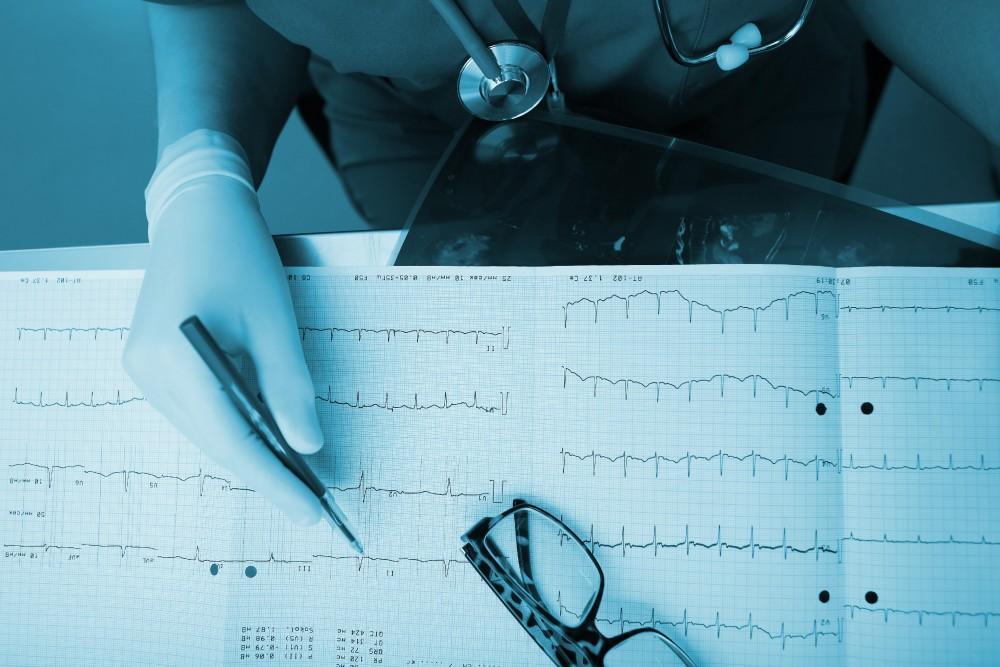 Electrophysiology Study: What to Expect